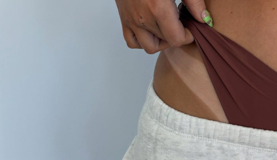 Why does fake tan go patchy