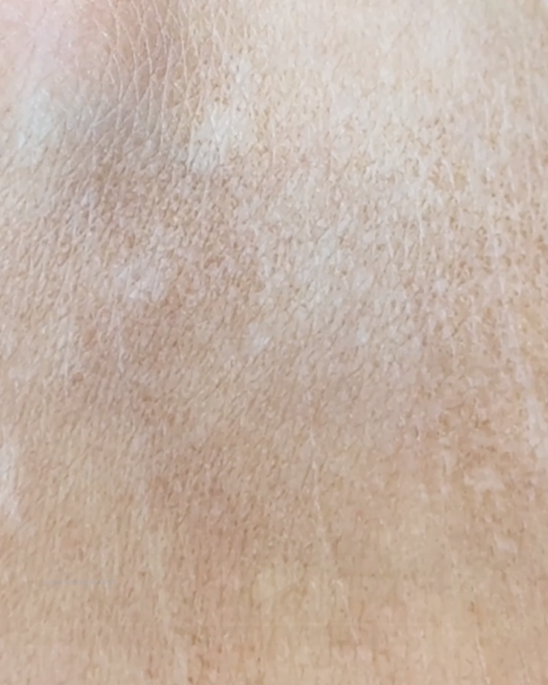 This tan remover is epic and works without making my skin red raw before