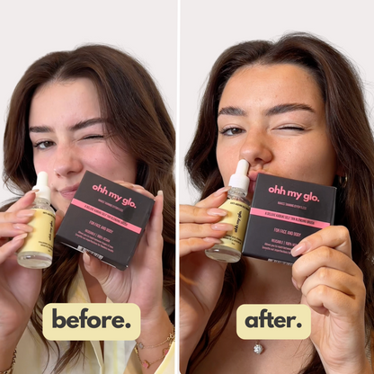 Models showing before and after glow using Ohh My Glo Anti-Ageing Glo Drops