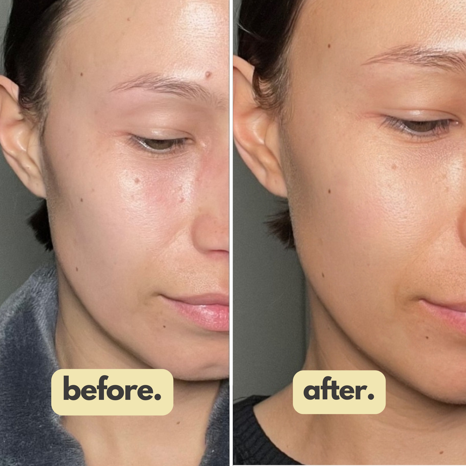 before and after glo drops